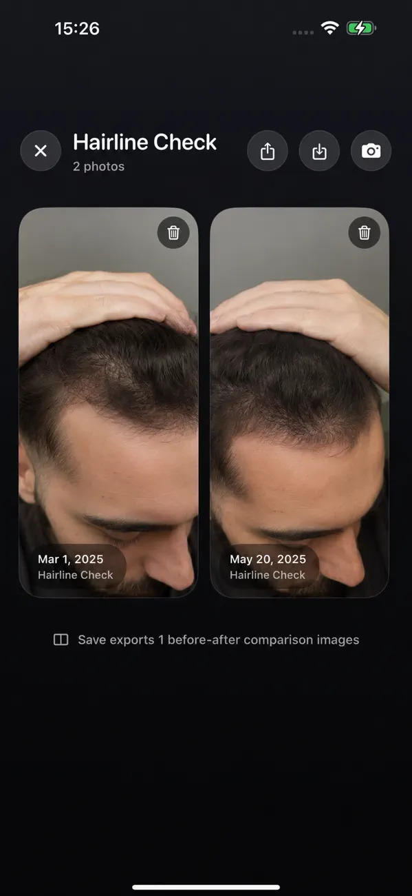 Hairline check