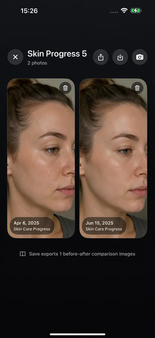 Watch skin progress